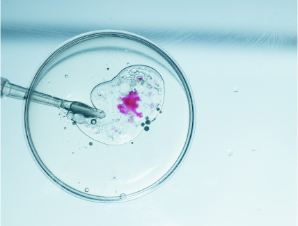 Assisted Reproductive Technologies (ART)