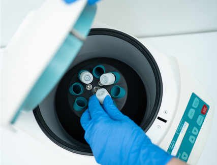 Fertility Preservation Services