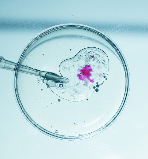 Assisted Reproductive Technologies (ART)